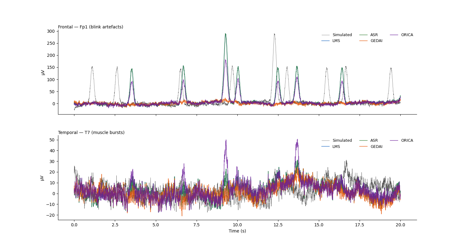 Frontal — Fp1 (blink artefacts), Temporal — T7 (muscle bursts)