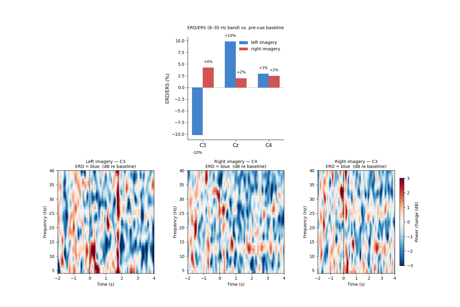 ERD/ERS (8–30 Hz band) vs. pre-cue baseline , Left imagery — C3 ERD = blue (dB re baseline), Right imagery — C4 ERD = blue (dB re baseline), Right imagery — C3 ERD = blue (dB re baseline)